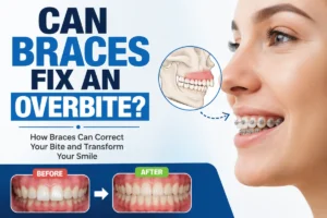 Can Braces Fix an Overbite?